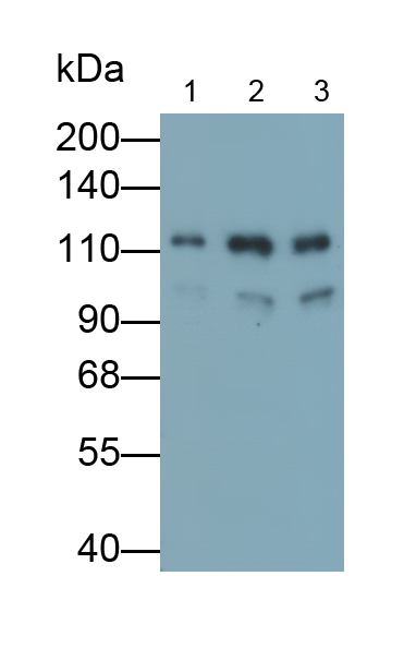 Monoclonal Antibody to E-cadherin