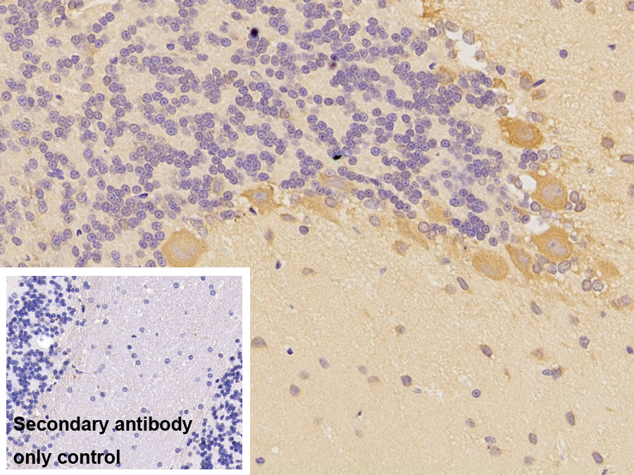 Monoclonal Antibody to Ciliary Neurotrophic Factor (CNTF)
