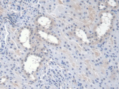 Monoclonal Antibody to Erythropoietin (EPO)