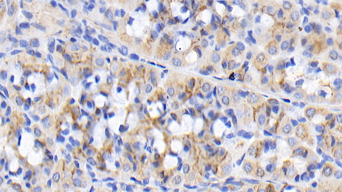 Monoclonal Antibody to Fibroblast Growth Factor 9 (FGF9)