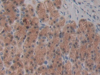 Monoclonal Antibody to Chemokine (C-X-C Motif) Ligand 1 (CXCL1)