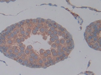 Monoclonal Antibody to Chemokine (C-X-C Motif) Ligand 1 (CXCL1)