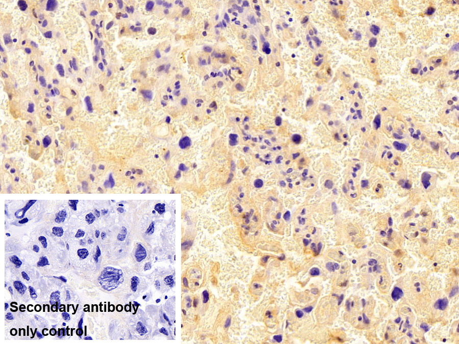 Monoclonal Antibody to Glycoprotein 130 (gp130)