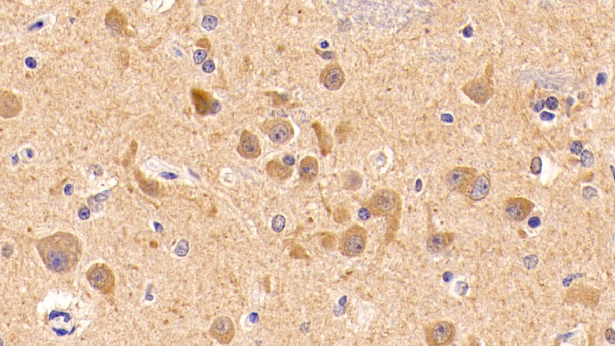 Monoclonal Antibody to Insulin Like Growth Factor 1 (IGF1)