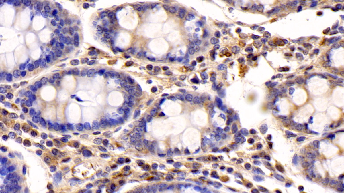 Monoclonal Antibody to Insulin Like Growth Factor 1 (IGF1)