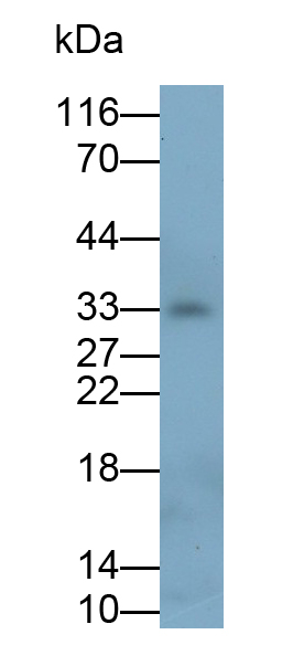 Monoclonal Antibody to Insulin Like Growth Factor Binding Protein 4 (IGFBP4)
