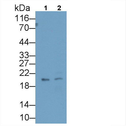 Monoclonal Antibody to Insulin Like Growth Factor Binding Protein 4 (IGFBP4)