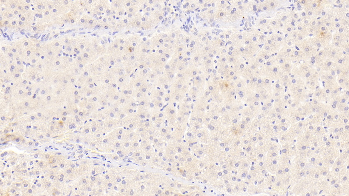 Monoclonal Antibody to Interleukin 12B (IL12B)