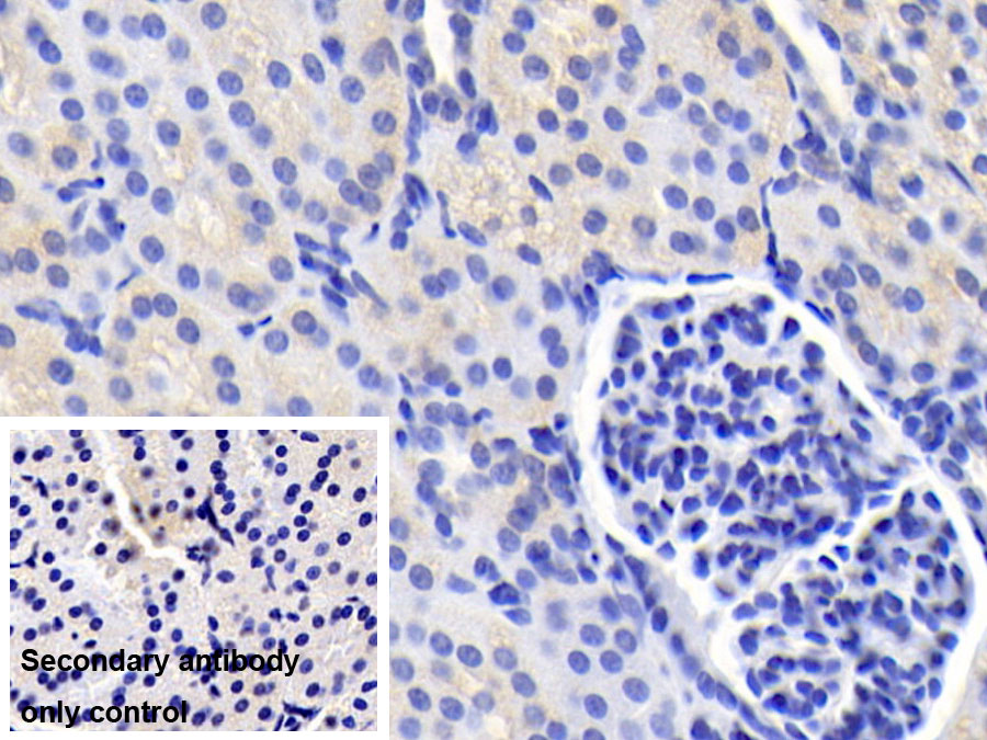 Monoclonal Antibody to Interleukin 12B (IL12B)