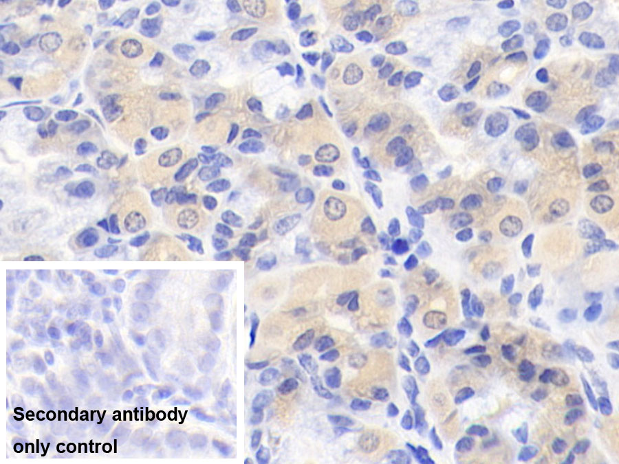 Monoclonal Antibody to Interleukin 12B (IL12B)