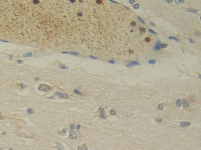 Monoclonal Antibody to Interleukin 12A (IL12A)