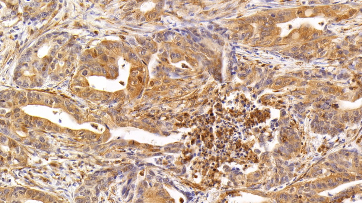 Monoclonal Antibody to Interleukin 17 (IL17)