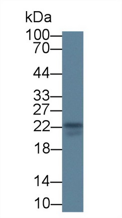 Monoclonal Antibody to Interleukin 18 (IL18)