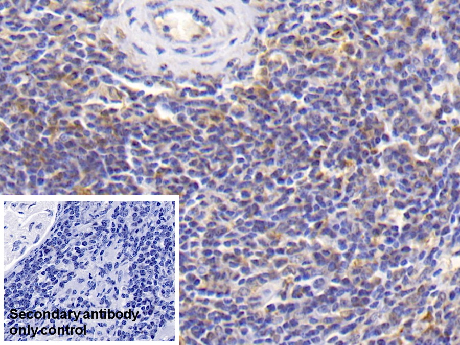 Monoclonal Antibody to Interleukin 18 (IL18)