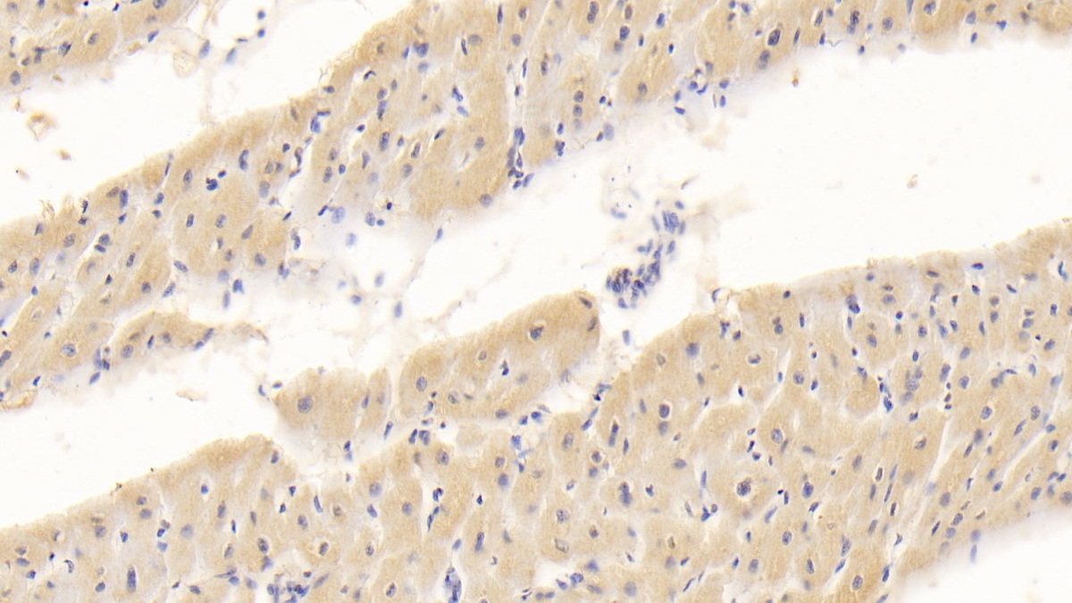 Monoclonal Antibody to Interleukin 18 (IL18)