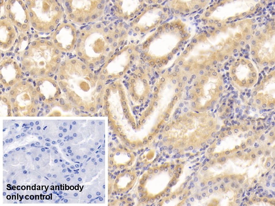 Monoclonal Antibody to Interleukin 18 (IL18)