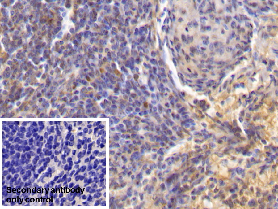 Monoclonal Antibody to Interleukin 18 (IL18)