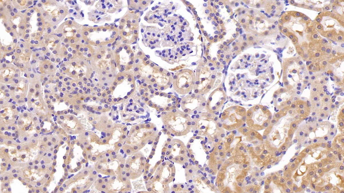 Monoclonal Antibody to Interleukin 18 (IL18)