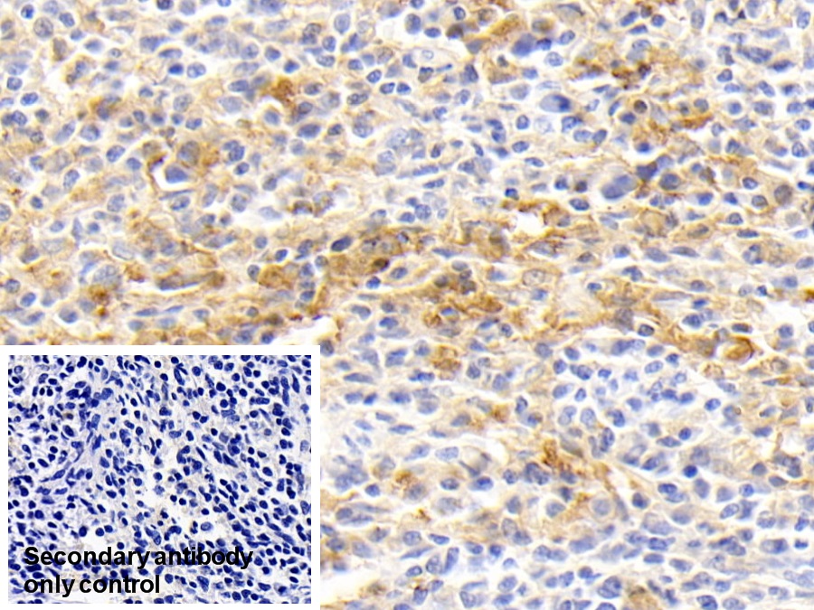 Monoclonal Antibody to Interleukin 18 (IL18)