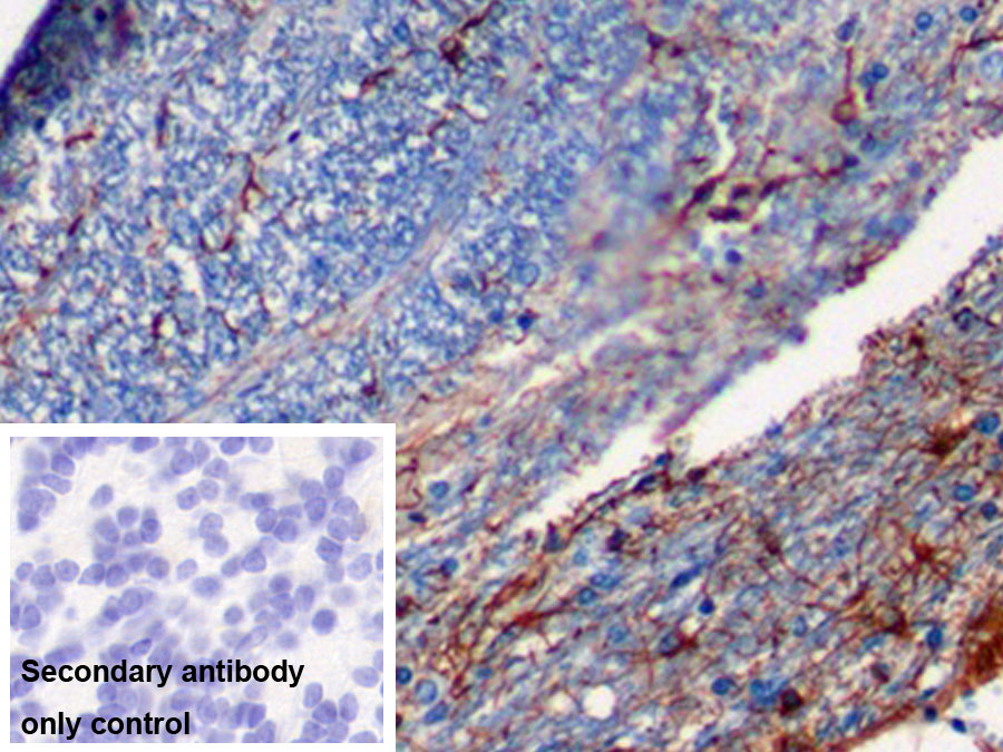 Monoclonal Antibody to Glial Fibrillary Acidic Protein (GFAP)