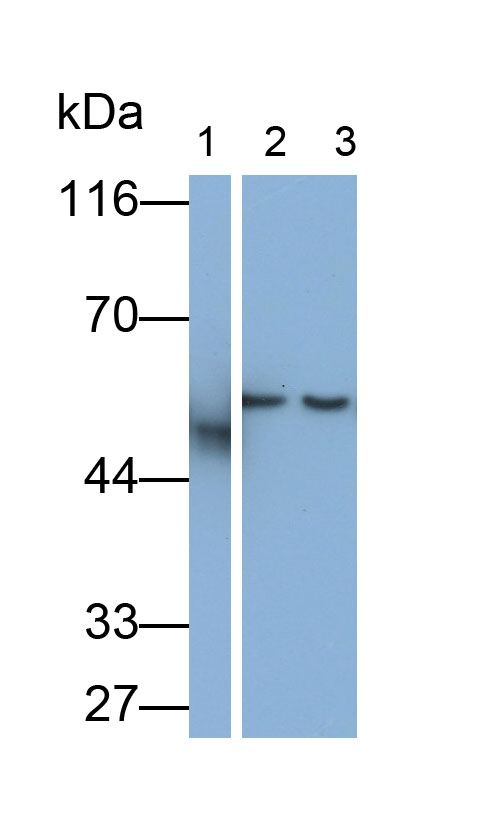 Monoclonal Antibody to Glial Fibrillary Acidic Protein (GFAP)