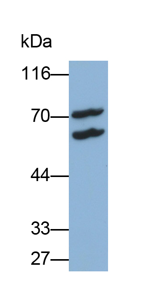 Monoclonal Antibody to Glial Fibrillary Acidic Protein (GFAP)