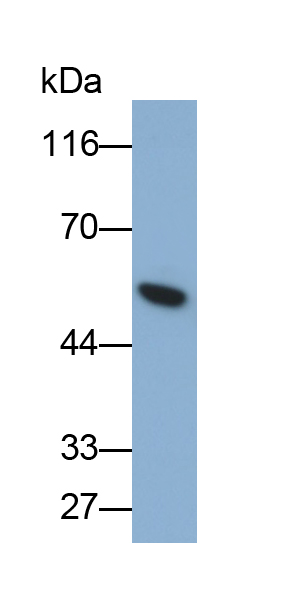 Monoclonal Antibody to Glial Fibrillary Acidic Protein (GFAP)