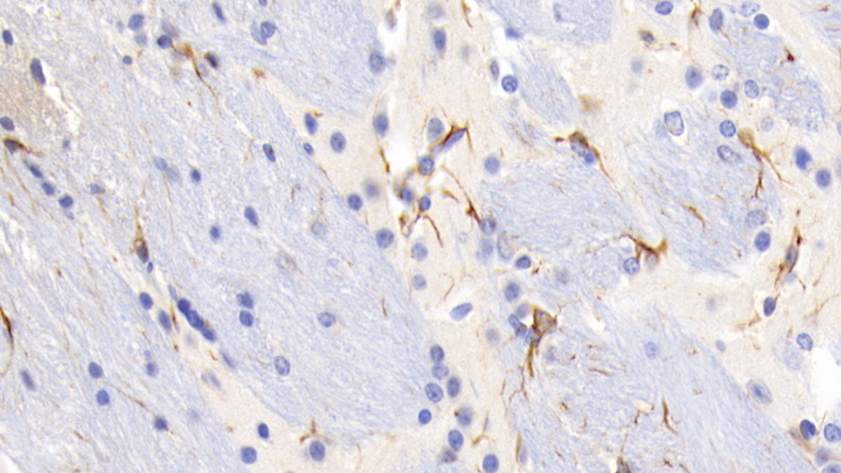 Monoclonal Antibody to Glial Fibrillary Acidic Protein (GFAP)