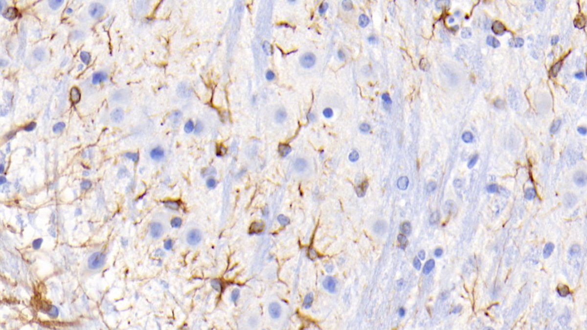 Monoclonal Antibody to Glial Fibrillary Acidic Protein (GFAP)