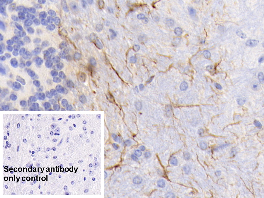 Monoclonal Antibody to Glial Fibrillary Acidic Protein (GFAP)