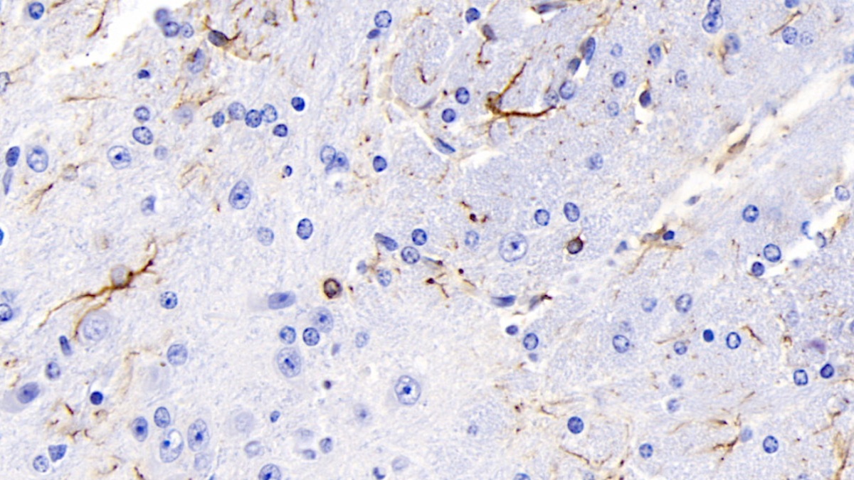 Monoclonal Antibody to Glial Fibrillary Acidic Protein (GFAP)