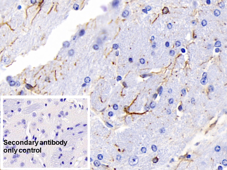 Monoclonal Antibody to Glial Fibrillary Acidic Protein (GFAP)