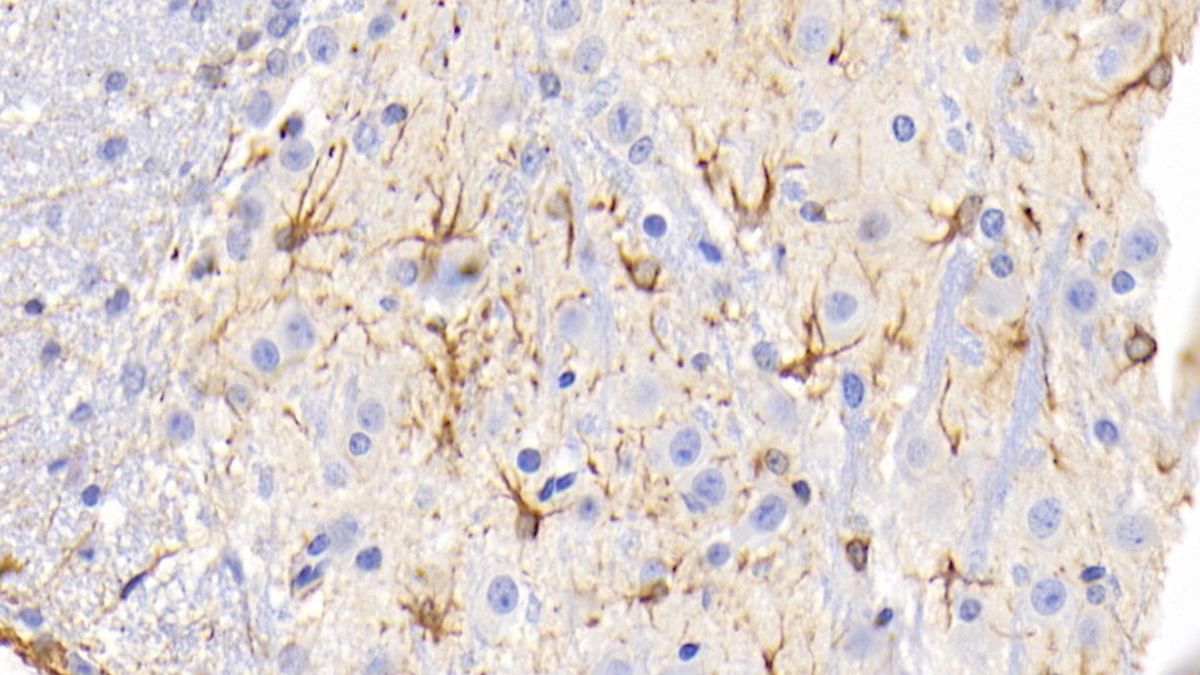 Monoclonal Antibody to Glial Fibrillary Acidic Protein (GFAP)