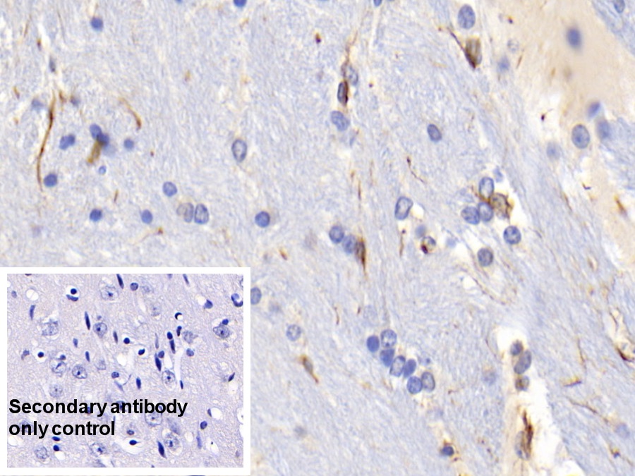 Monoclonal Antibody to Glial Fibrillary Acidic Protein (GFAP)