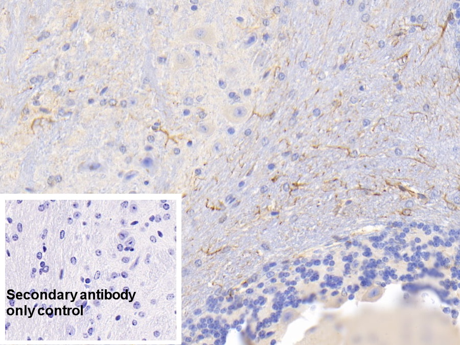 Monoclonal Antibody to Glial Fibrillary Acidic Protein (GFAP)