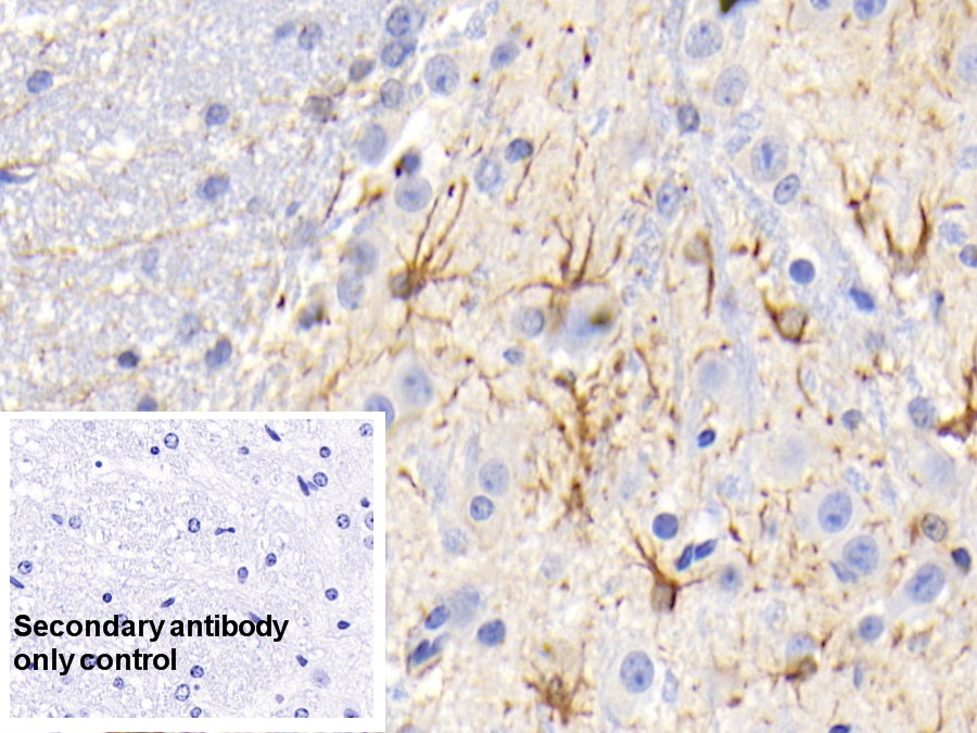 Monoclonal Antibody to Glial Fibrillary Acidic Protein (GFAP)