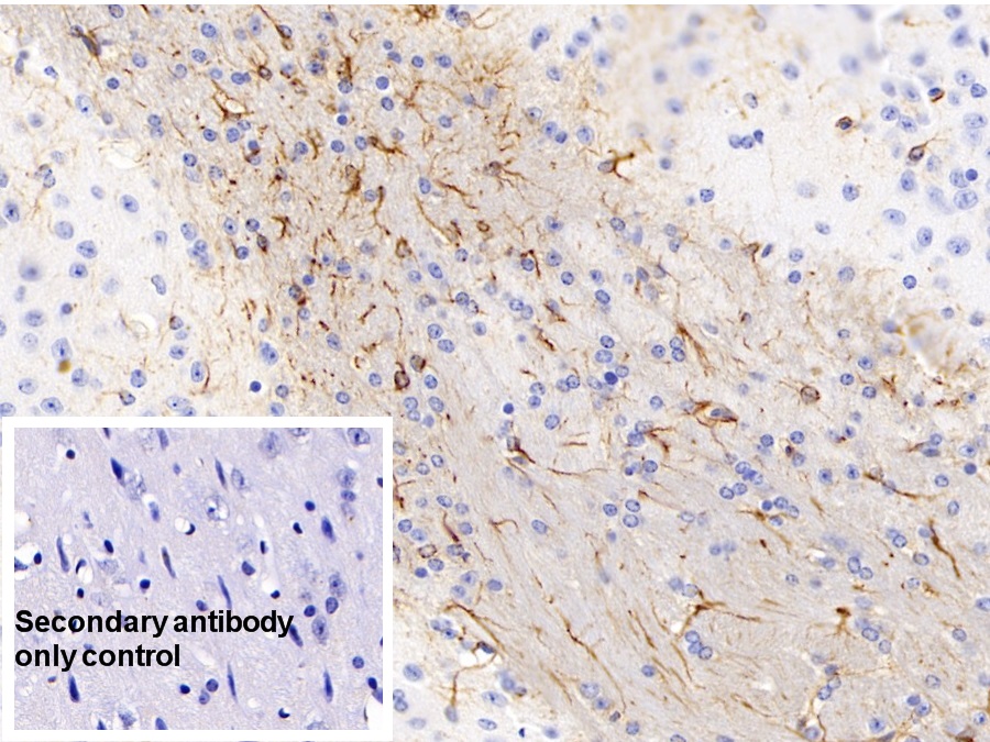 Monoclonal Antibody to Glial Fibrillary Acidic Protein (GFAP)