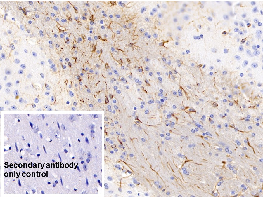 Monoclonal Antibody to Glial Fibrillary Acidic Protein (GFAP)