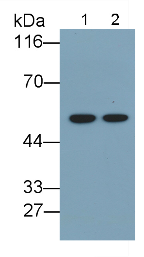 Monoclonal Antibody to Glial Fibrillary Acidic Protein (GFAP)