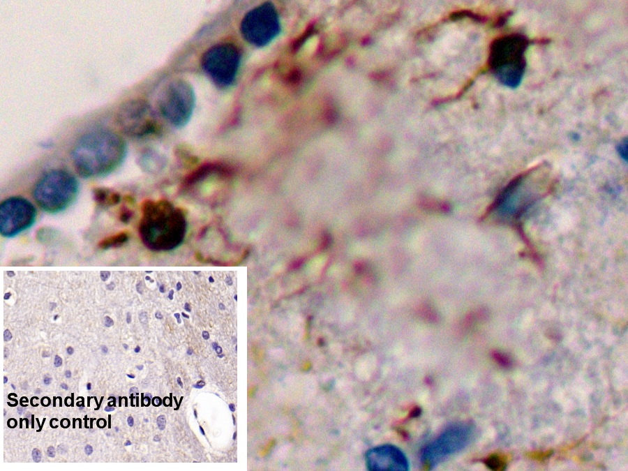 Monoclonal Antibody to Glial Fibrillary Acidic Protein (GFAP)