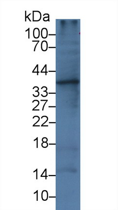 Monoclonal Antibody to Interleukin 1 Alpha (IL1a)