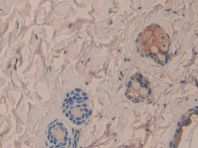 Monoclonal Antibody to Interleukin 1 Alpha (IL1a)