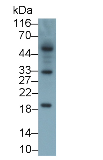 Monoclonal Antibody to Interleukin 2 (IL2)