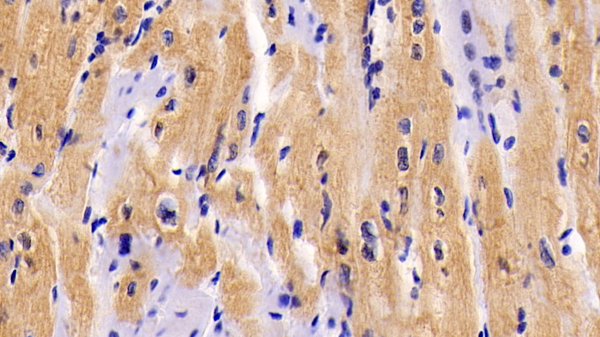 Monoclonal Antibody to Interleukin 6 (IL6)