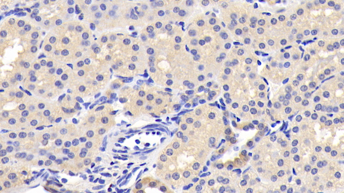 Monoclonal Antibody to Leptin (LEP)