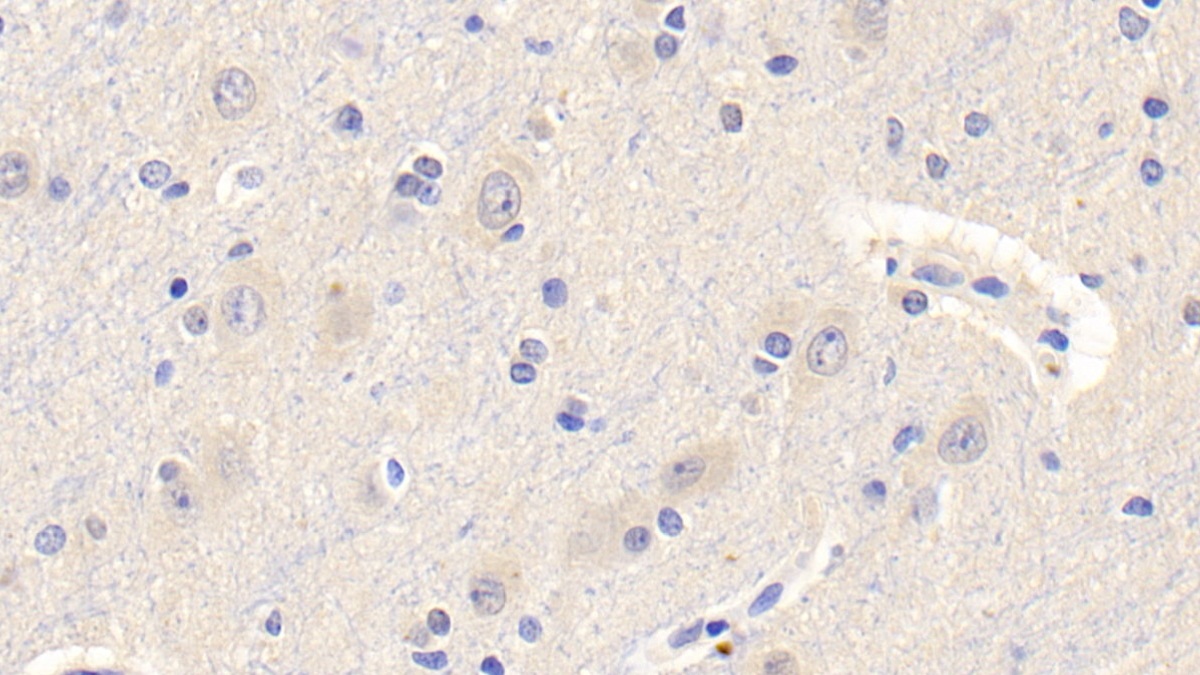 Monoclonal Antibody to Leptin (LEP)