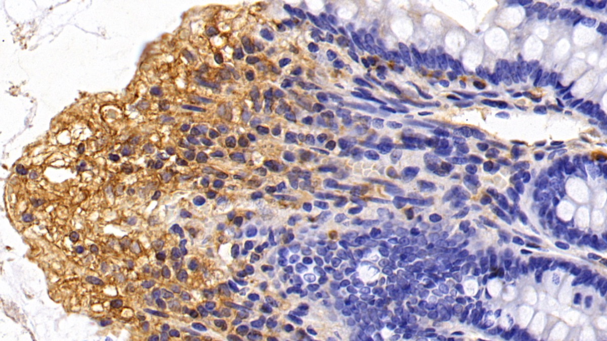 Monoclonal Antibody to Macrophage Inflammatory Protein 1 Alpha (MIP1a)