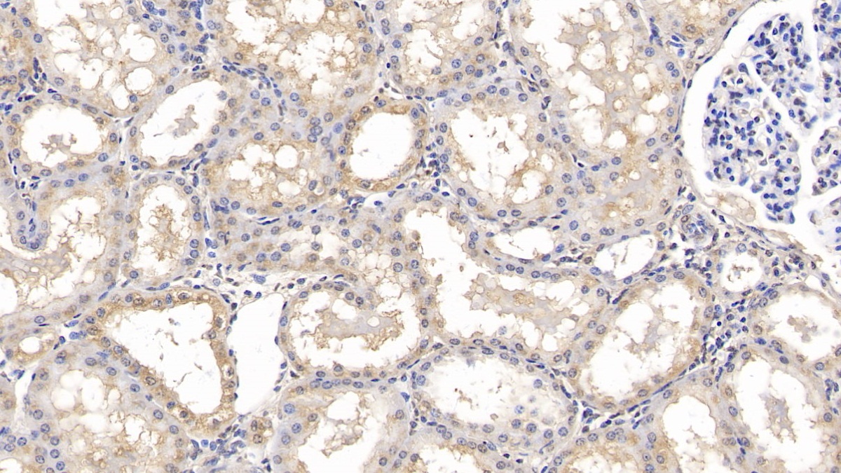 Monoclonal Antibody to Matrix Metalloproteinase 13 (MMP13)