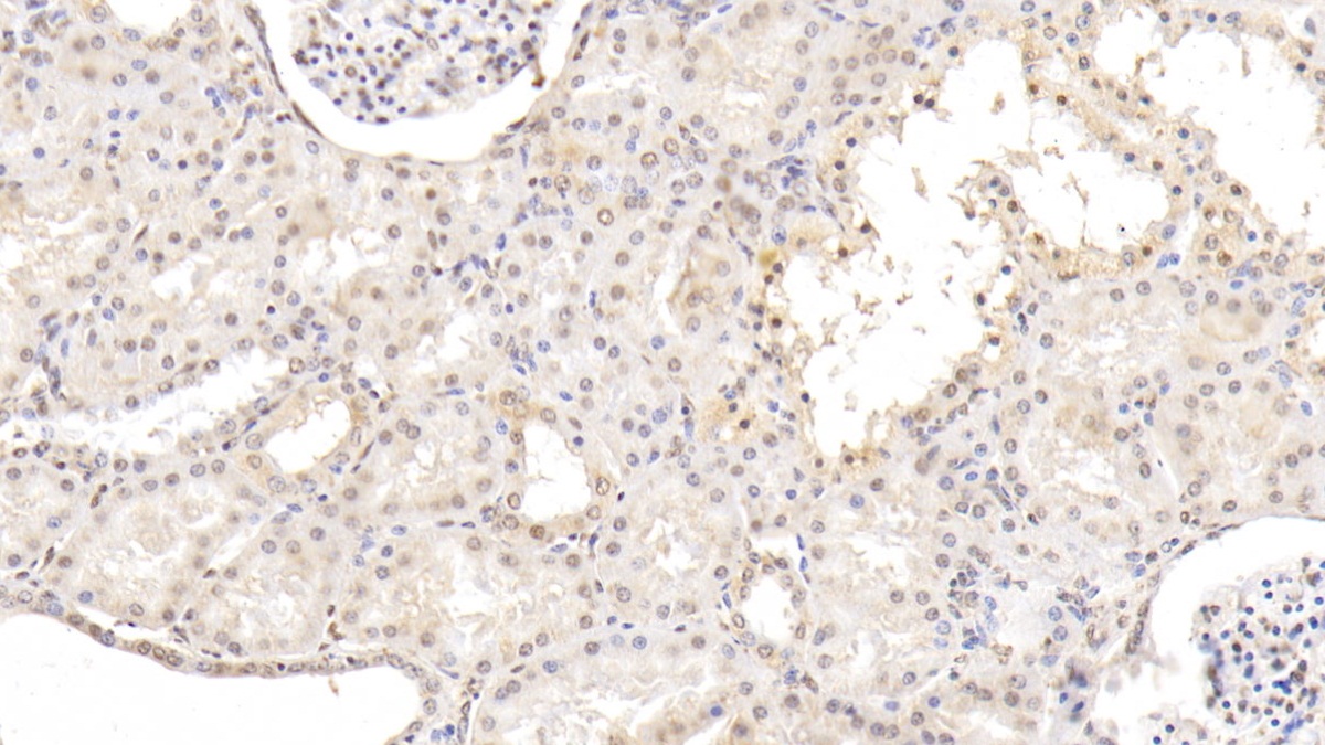Monoclonal Antibody to Matrix Metalloproteinase 13 (MMP13)