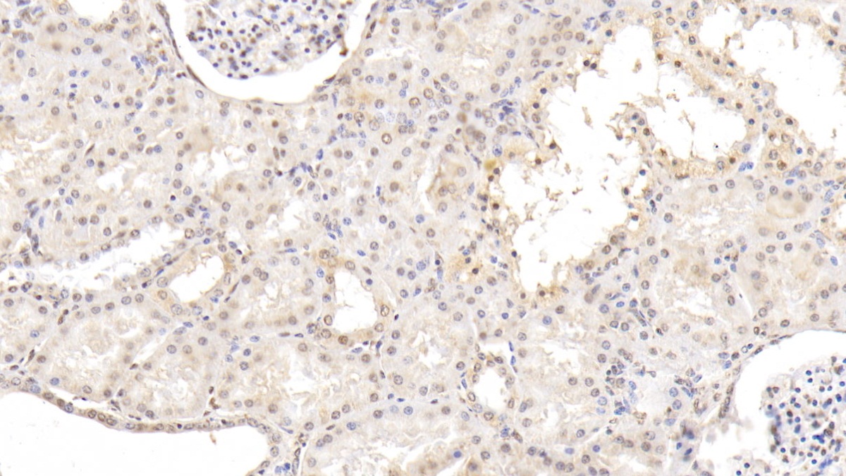 Monoclonal Antibody to Matrix Metalloproteinase 13 (MMP13)